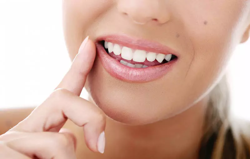 Bonding zębów – co to takiego?